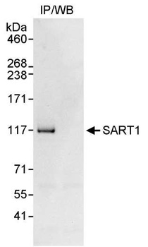 Rabbit anti-SART1 Antibody, Affinity Purified