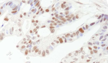 Rabbit anti-DFF45/DFFA Antibody, Affinity Purified