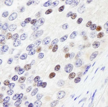 Rabbit anti-ZHX3 Antibody, Affinity Purified