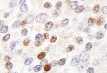 Rabbit anti-ZHX3 Antibody, Affinity Purified