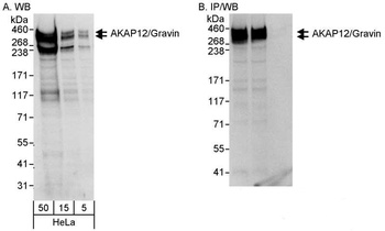 Rabbit anti-AKAP12/Gravin Antibody, Affinity Purified
