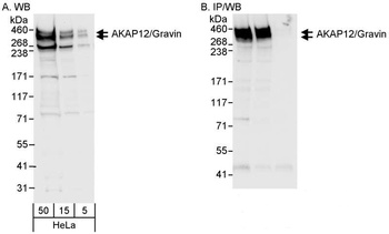 Rabbit anti-AKAP12/Gravin Antibody, Affinity Purified