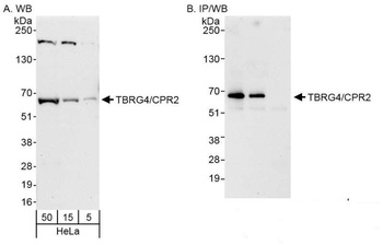 Rabbit anti-TBRG4/CPR2 Antibody, Affinity Purified