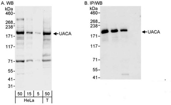 Rabbit anti-UACA Antibody, Affinity Purified
