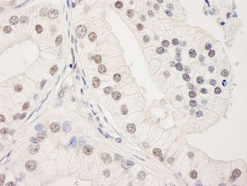 Rabbit anti-UACA Antibody, Affinity Purified