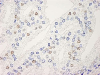 Rabbit anti-UACA Antibody, Affinity Purified