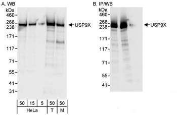 Rabbit anti-USP9X Antibody, Affinity Purified