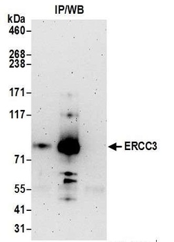 Rabbit anti-ERCC3 Antibody, Affinity Purified