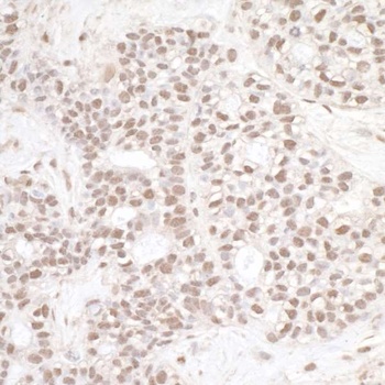 Rabbit anti-ERCC3 Antibody, Affinity Purified