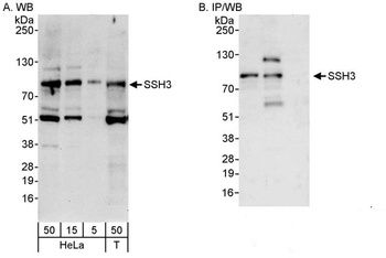 Rabbit anti-SSH3 Antibody, Affinity Purified