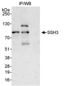 Rabbit anti-SSH3 Antibody, Affinity Purified