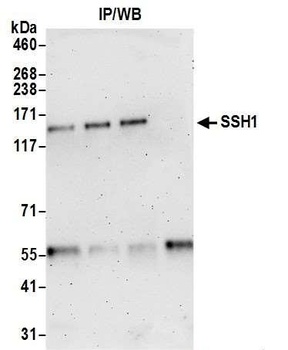 Rabbit anti-SSH1 Antibody, Affinity Purified