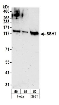 Rabbit anti-SSH1 Antibody, Affinity Purified