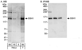 Rabbit anti-SSH1 Antibody, Affinity Purified