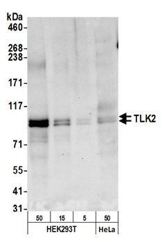 Rabbit anti-TLK2 Antibody, Affinity Purified