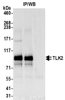 Rabbit anti-TLK2 Antibody, Affinity Purified