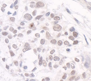 Rabbit anti-GTF3C3/TFIIIC102 Antibody, Affinity Purified