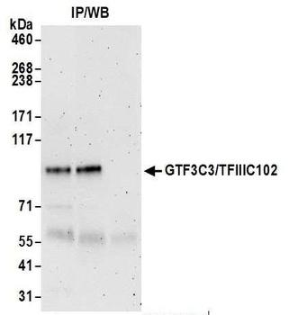 Rabbit anti-GTF3C3/TFIIIC102 Antibody, Affinity Purified