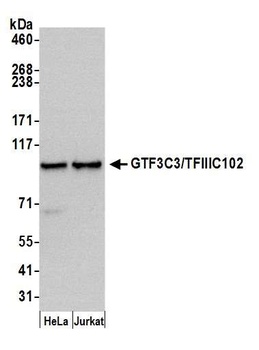Rabbit anti-GTF3C3/TFIIIC102 Antibody, Affinity Purified
