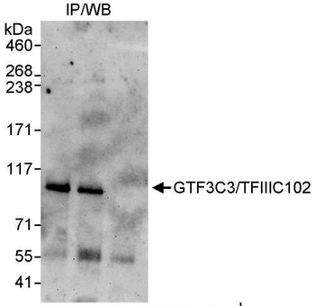 Rabbit anti-GTF3C3/TFIIIC102 Antibody, Affinity Purified
