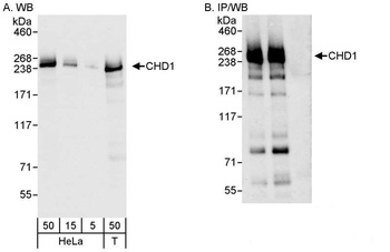 Rabbit anti-CHD1 Antibody, Affinity Purified