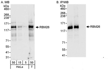 Rabbit anti-RBM26 Antibody, Affinity Purified