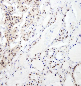 Rabbit anti-RBM26 Antibody, Affinity Purified