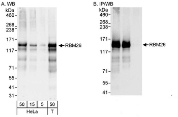 Rabbit anti-RBM26 Antibody, Affinity Purified