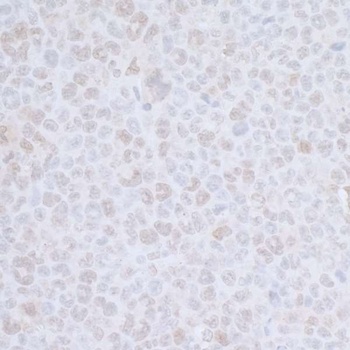 Rabbit anti-CDC20 Antibody, Affinity Purified
