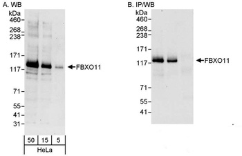 Rabbit anti-FBXO11 Antibody, Affinity Purified