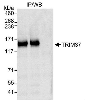 Rabbit anti-TRIM37 Antibody, Affinity Purified