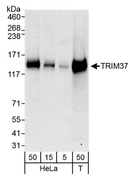 Rabbit anti-TRIM37 Antibody, Affinity Purified