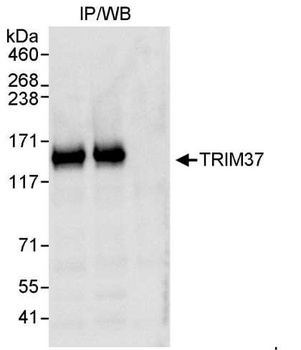 Rabbit anti-TRIM37 Antibody, Affinity Purified