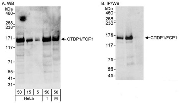 Rabbit anti-CTDP1/FCP1 Antibody, Affinity Purified