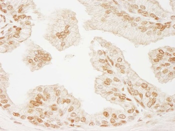 Rabbit anti-PML Antibody, Affinity Purified