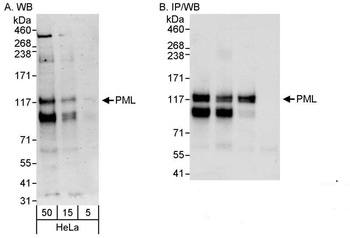 Rabbit anti-PML Antibody, Affinity Purified