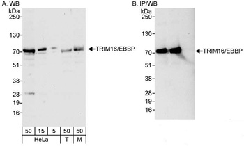 Rabbit anti-TRIM16/EBBP Antibody, Affinity Purified