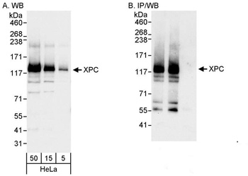 Rabbit anti-XPC Antibody, Affinity Purified
