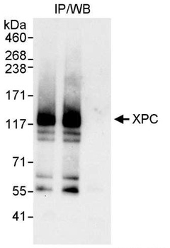 Rabbit anti-XPC Antibody, Affinity Purified