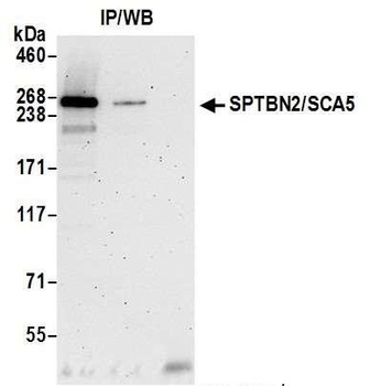 Rabbit anti-SPTBN2/SCA5 Antibody, Affinity Purified
