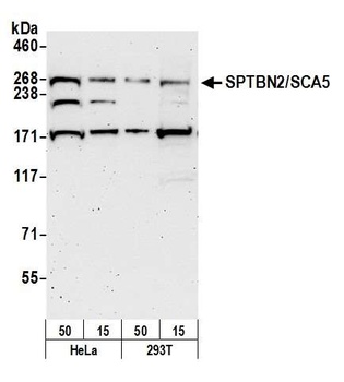Rabbit anti-SPTBN2/SCA5 Antibody, Affinity Purified