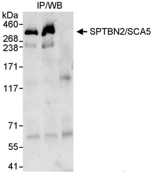 Rabbit anti-SPTBN2/SCA5 Antibody, Affinity Purified