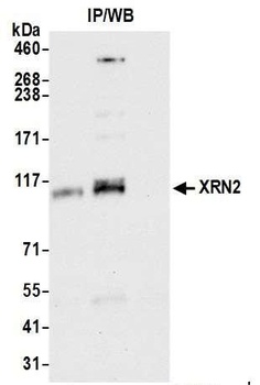 Rabbit anti-XRN2 Antibody, Affinity Purified