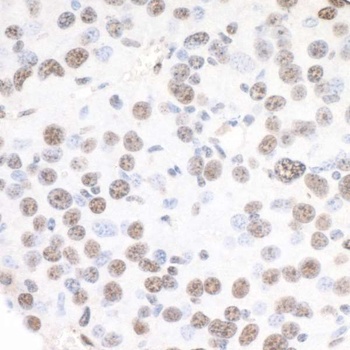 Rabbit anti-XRN2 Antibody, Affinity Purified