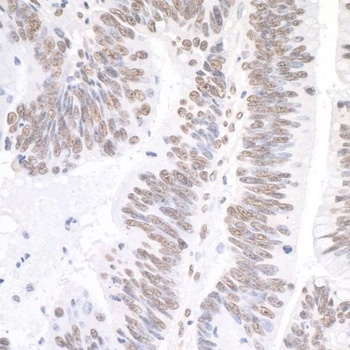 Rabbit anti-XRN2 Antibody, Affinity Purified