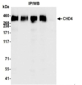 Rabbit anti-CHD4 Antibody, Affinity Purified