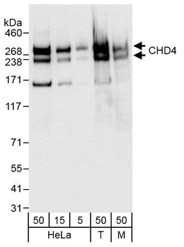 Rabbit anti-CHD4 Antibody, Affinity Purified