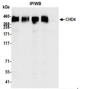 Rabbit anti-CHD4 Antibody, Affinity Purified