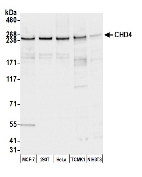 Rabbit anti-CHD4 Antibody, Affinity Purified