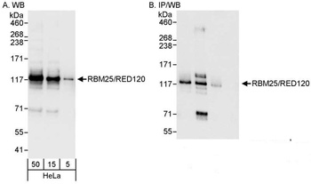 Rabbit anti-RBM25/RED120 Antibody, Affinity Purified